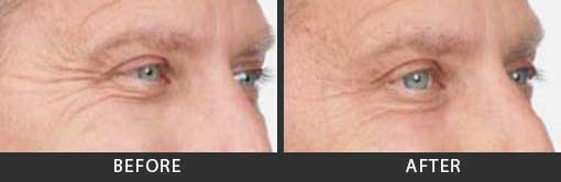 Before and After Photo