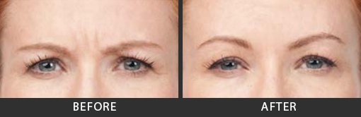 Before and After Photo