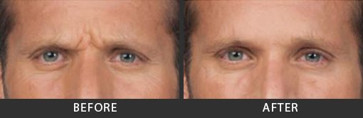 Before and After Photo