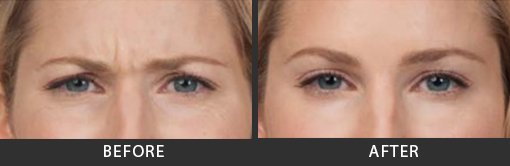 Before and After Photo