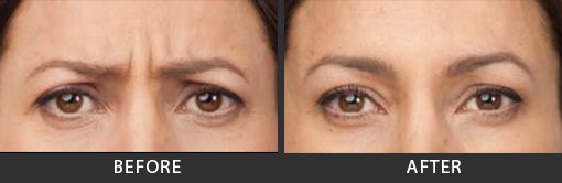 Before and After Photo