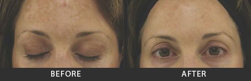 Before and After Photo