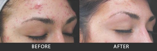 Before and After Photo