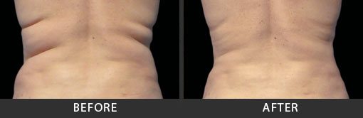 Before and After Photo