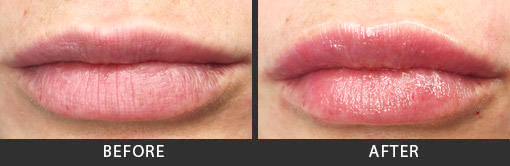 Before and After Photo