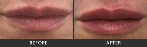 Before and After Photo