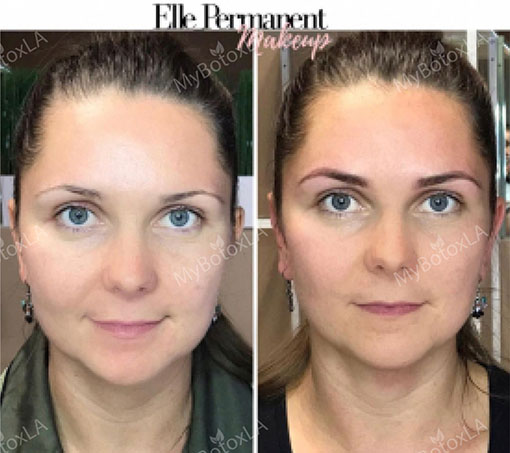 Before and After Photo