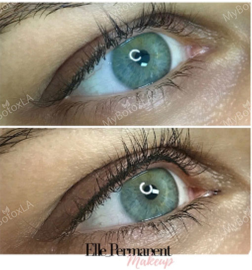 Before and After Photo