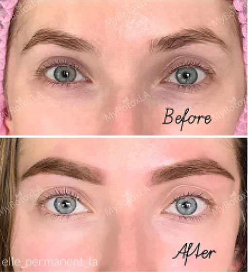 Before and After Photo