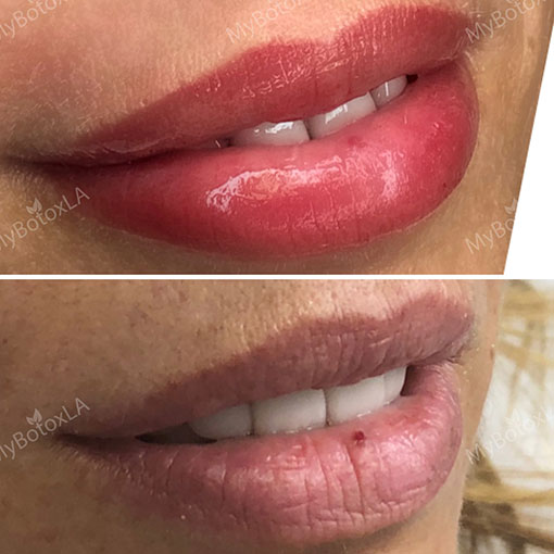 Before and After Photo