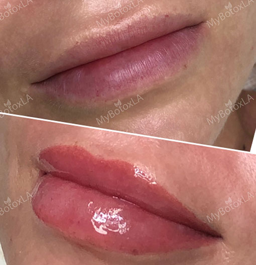 Before and After Photo