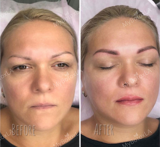 Before and After Photo