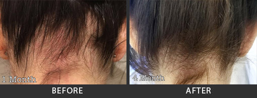 Before and After Photo