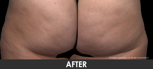 Before and After Photo