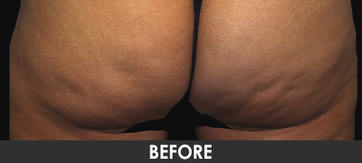 Before and After Photo