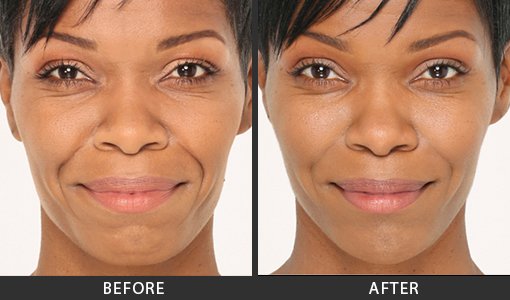 Before and After Photo