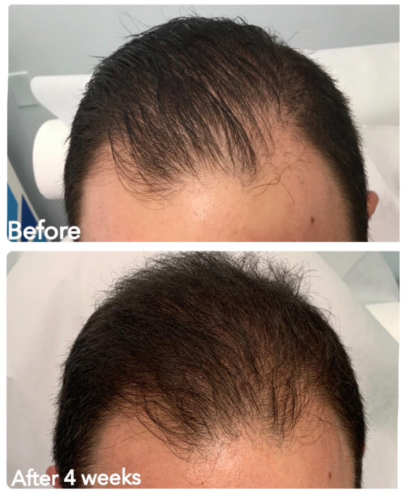 Before and After Photo