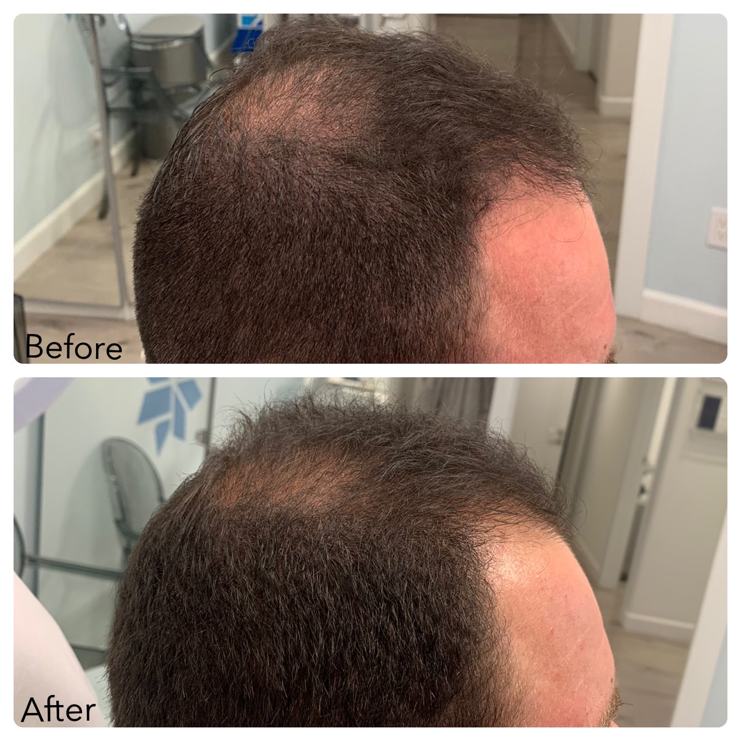 Before and After Photo