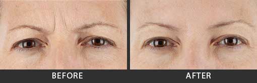 Before and After Photo