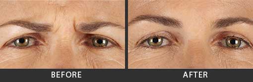 Before and After Photo