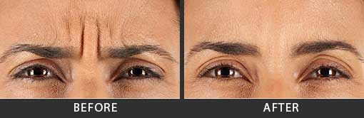 Before and After Photo