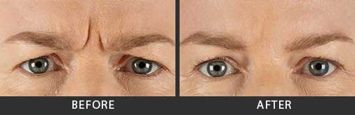 Before and After Photo