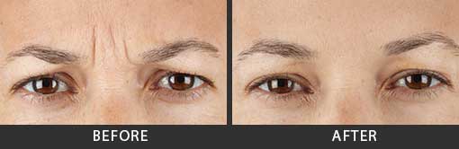 Before and After Photo