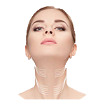 Neck Lift
